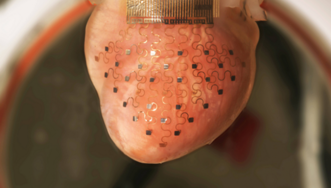 Inovatie deosebita in cardiologie: membrana care va inlocui stimulatoarele cardiaca si pacemaker-urile