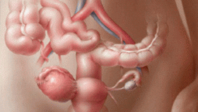Cancerul ovarian sau „asasinul tacut” – simptome si teste pentru diagnosticarea acestei boli Cancerul ovarian sau „asasinul tacut” – simptome si teste pentru diagnosticarea acestei boli