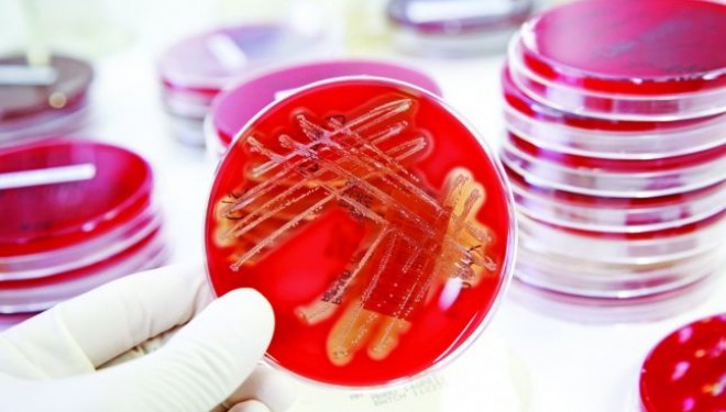 Controlul lumii, preluat de bacterii. Afectiuni tratate incorect in Romania Controlul lumii, preluat de bacterii. Afectiuni tratate incorect in Romania