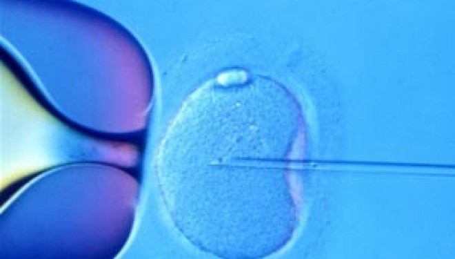 Tratamentele pentru fertilitate ameninta structura umana, avertizeaza pionierul fertilizarii in vitro Robert Winston Tratamentele pentru fertilitate ameninta structura umana, avertizeaza pionierul fertilizarii in vitro Robert Winston