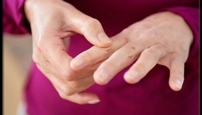 Lupus: expunerea la soare poate duce la agravarea bolii! Lupus: expunerea la soare poate duce la agravarea bolii!