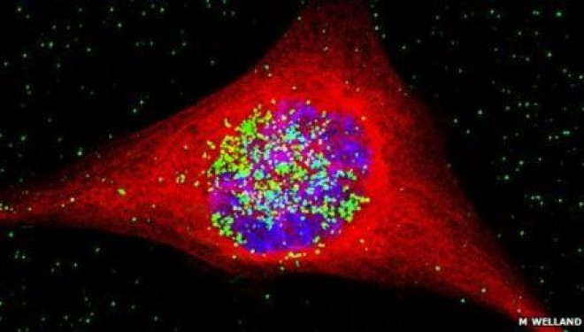 Particule de aur utilizate in terapia impotriva cancerului cerebral Particule de aur utilizate in terapia impotriva cancerului cerebral