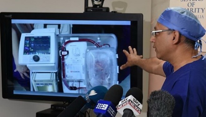VIDEO Tehnica INOVATOAREA: transplant cardiac utilizand o inima care incetase sa bata VIDEO Tehnica INOVATOAREA: transplant cardiac utilizand o inima care incetase sa bata
