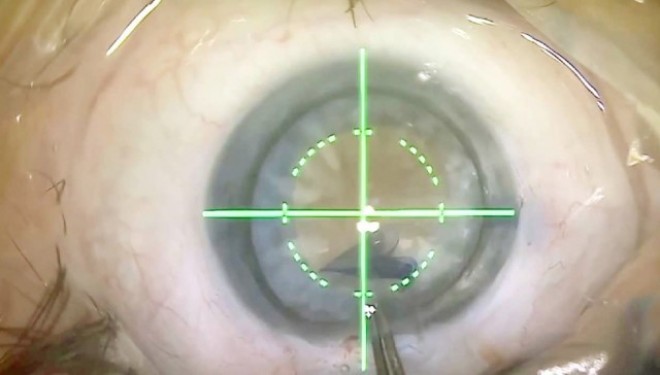 Retinopatia diabetica: o condamnare la orbire? Diagnosticul precoce si tratamentul corect pot salva vederea! Retinopatia diabetica: o condamnare la orbire? Diagnosticul precoce si tratamentul corect pot salva vederea!