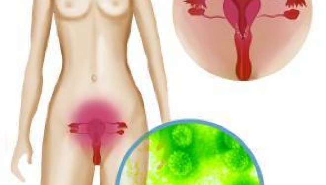 Cum poate fi invins virusul HPV. Analizele pe care medicii le recomanda pentru depistarea precoce si vindecarea sigura Cum poate fi invins virusul HPV. Analizele pe care medicii le recomanda pentru depistarea precoce si vindecarea sigura
