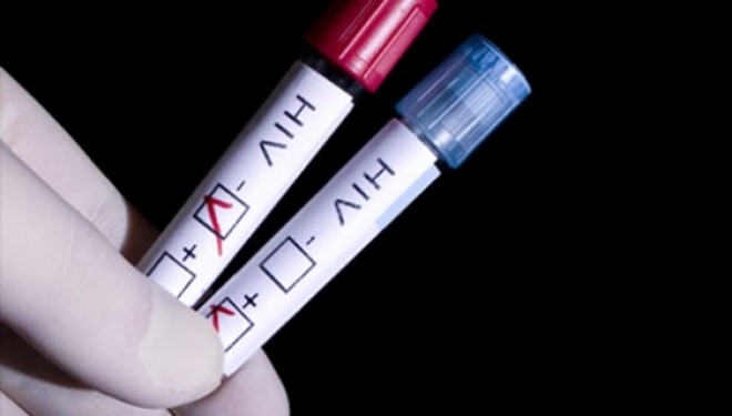 Progrese mari pentru obținerea unui vaccin contra HIV