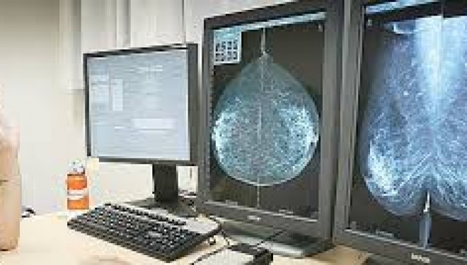 Cea mai moderna tehnologie de examinare a sanului.Mamografia digitala cu tomosinteza reduce iradierea si expunerile suplimentare Cea mai moderna tehnologie de examinare a sanului.Mamografia digitala cu tomosinteza reduce iradierea si expunerile suplimentare