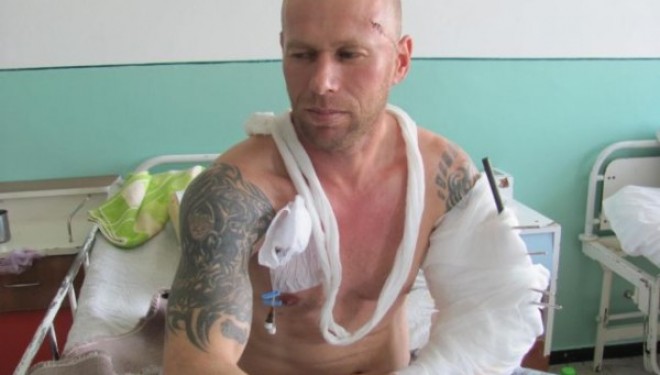 Performanta medicala la Barlad. Medicii au refacut nu doar un brat zdrobit, ci si tatuajul de pe mana Performanta medicala la Barlad. Medicii au refacut nu doar un brat zdrobit, ci si tatuajul de pe mana