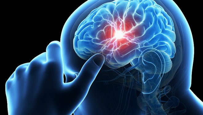 Accidentul vascular cerebral, tot mai frecvent la tineri Accidentul vascular cerebral, tot mai frecvent la tineri