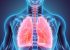 Cancerul pulmonar la cei care nu au fumat niciodată este mai frecvent decât se crede