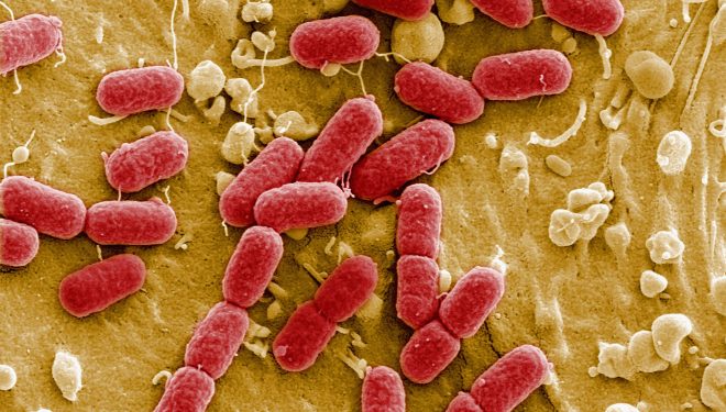 O bacterie rară a ucis 12 britanici şi a îmbolnăvit alţi 20 O bacterie rară a ucis 12 britanici şi a îmbolnăvit alţi 20