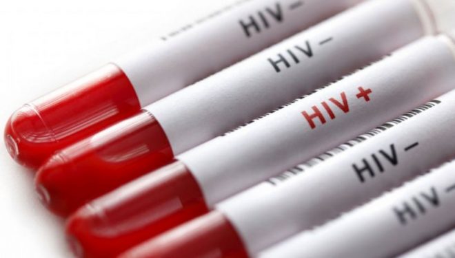 Oamenii de
ştiinţă americani au reuşit să elimine virusul HIV la şoareci. Studiu Oamenii de
ştiinţă americani au reuşit să elimine virusul HIV la şoareci. Studiu