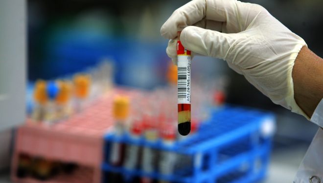 Tot ce trebuie să ştii despre Listeria, bacteria care a alertat întreaga lume. Cum recunoşti simptomele şi cum se tratează Tot ce trebuie să ştii despre Listeria, bacteria care a alertat întreaga lume. Cum recunoşti simptomele şi cum se tratează