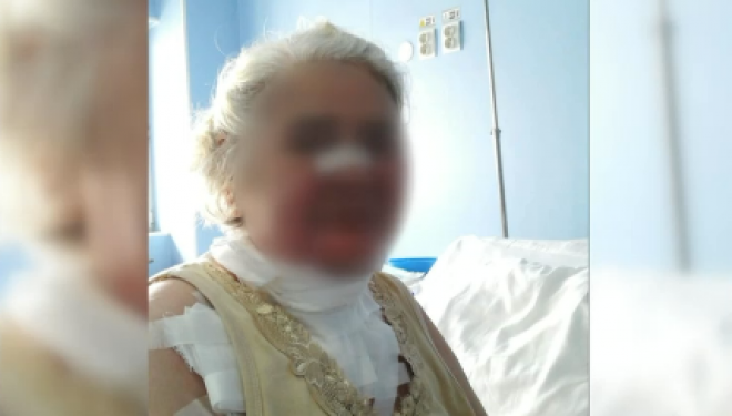 Spitalul Sf. Maria, reacție în cazul pacientei care a suferit arsuri în sala de operație: Nu cere scuze, dar amenință jurnaliștii Spitalul Sf. Maria, reacție în cazul pacientei care a suferit arsuri în sala de operație: Nu cere scuze, dar amenință jurnaliștii