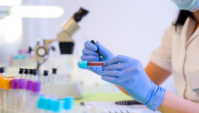 Testul de sânge care „poate depista mai mult de 50 de tipuri de cancer” Testul de sânge care „poate depista mai mult de 50 de tipuri de cancer”