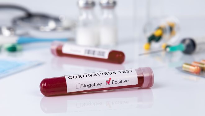 INSP a actualizat definițiile de caz pentru coronavirus. 13 categorii de persoane, testate cu prioritate INSP a actualizat definițiile de caz pentru coronavirus. 13 categorii de persoane, testate cu prioritate