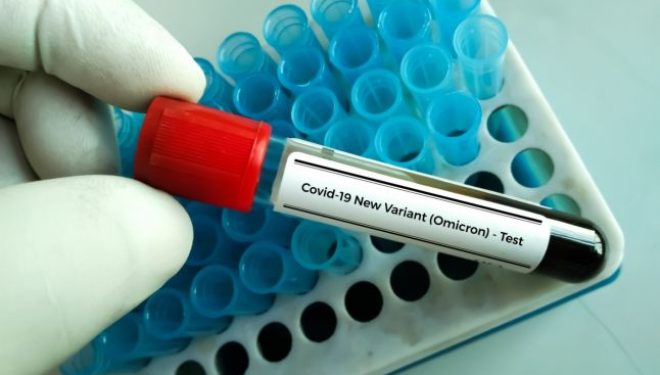 Expert german în imunologie: „Varianta Omicron a coronavirusului ar fi apărut pentru prima dată la un pacient cu HIV”
