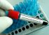 Expert german în imunologie: „Varianta Omicron a coronavirusului ar fi apărut pentru prima dată la un pacient cu HIV”