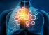 Dr. Gina Ciolan, pneumolog: „Chiar dacă este o boală cronică, pacienţii care suferă de astm sever pot avea perioade lungi de timp fără simptomatologie“