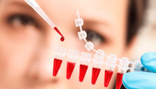 Un test de sânge ar putea depista cancerul înainte ca pacienții să prezinte simptome STUDIU